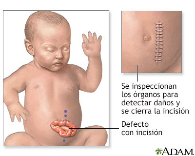 Intestinos durante el embarazo