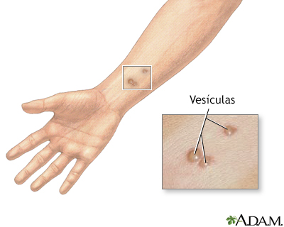 Atopichesky la dermatitis los consejos a los padres